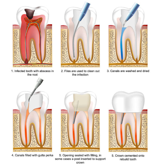 Meso Dental